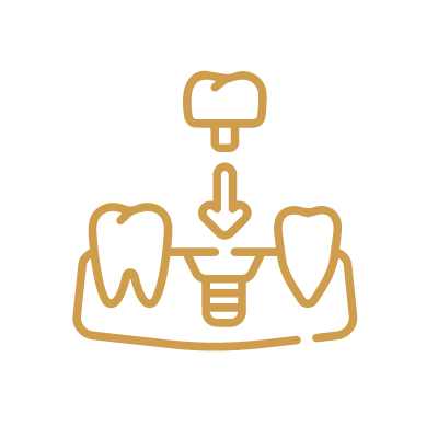 Dinti ficsi pe implanturi